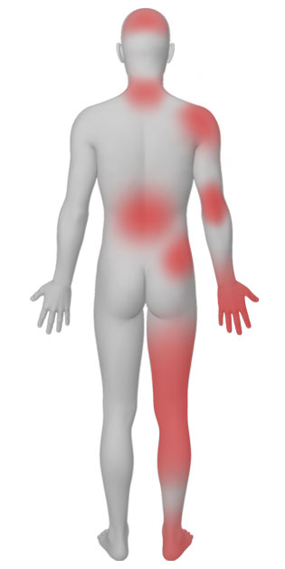 graphic of man with red spots all over body back