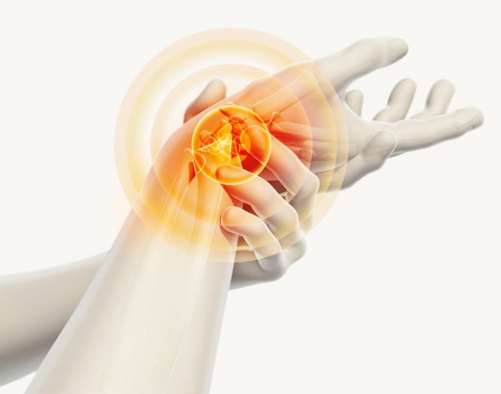 Image of child with carpal tunnel.